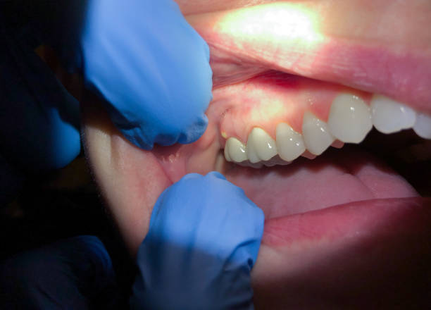 Best Pediatric Emergency Dentist in China Grove, TX