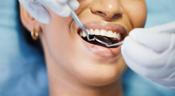Best Weekend Emergency Dentist in China Grove, TX